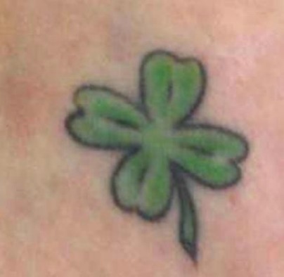 TATTOO removal pulse light clinic - green-after