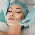 The 5 Most Common Benefits of Facial Peels