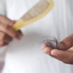 How To Address Hair Loss And Restoration Methods