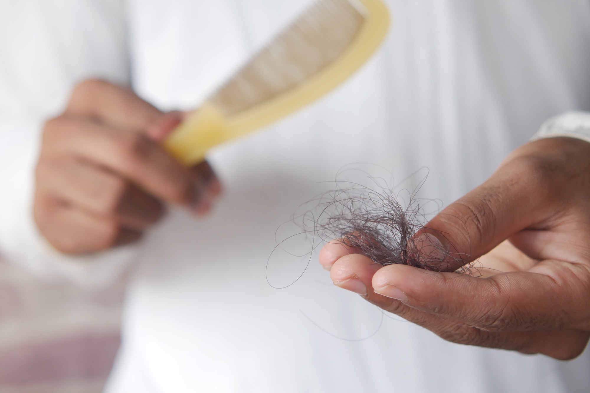 Read more about the article How To Address Hair Loss And Restoration Methods