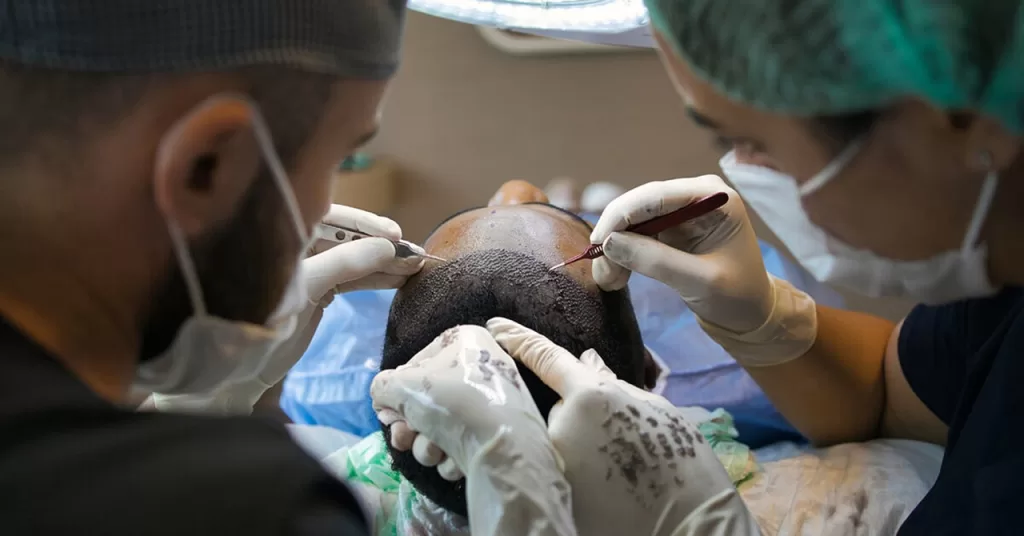 The Evolution of Hair Transplant Techniques: Past, Present, and Future | Health & Beauty | Elle Blonde Luxury Lifestyle Destination Blog