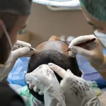 5 Things You Need To Know About The Evolution Of Hair Transplant Techniques