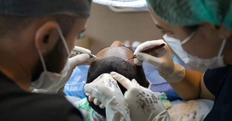 Read more about the article 5 Things You Need To Know About The Evolution Of Hair Transplant Techniques