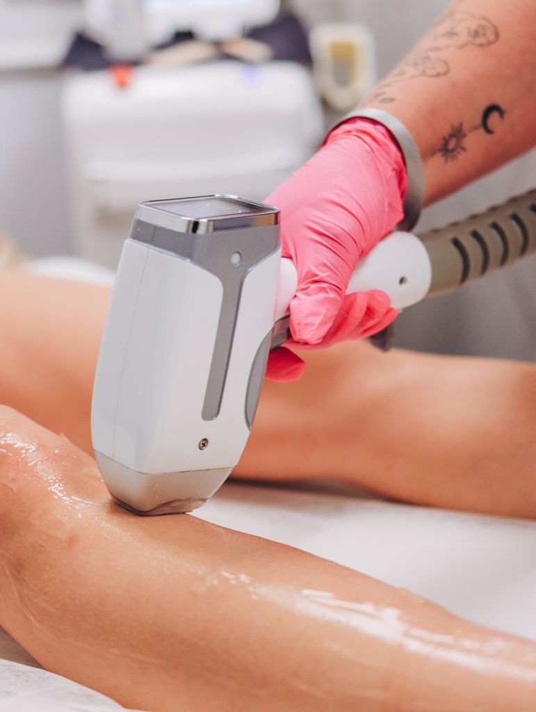 Close-up of laser hair removal on a client's leg in a professional clinic setting.